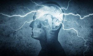 Ect Services | Electroconvulsive Therapy (ECT) | Shock Therapy
